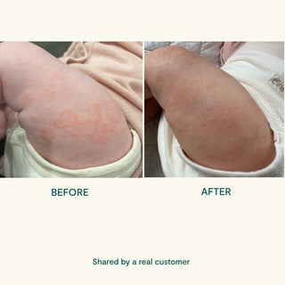BEETL Baby Cream 250ml - Kollektive - Official distributor